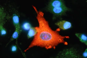 Immunofluorescent LM of an active macrophage Immunofluorescent LM of an active macrophage