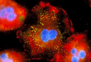 Immunofluorescent LM of active macrophages Immunofluorescent LM of active macrophages