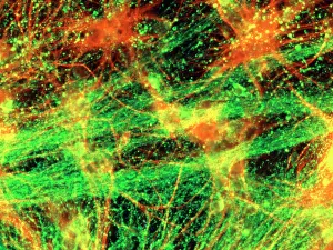 Immunofluorescent LM of neurons & astrocytes Immunofluorescent LM of neurons & astrocytes