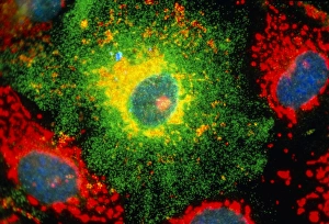 Immunofluorescent LM of recombinant culture cells Immunofluorescent LM of recombinant culture cells