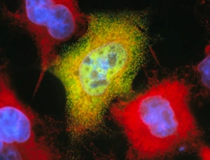 Immunofluorescent LM of recombinant monkey cells Immunofluorescent LM of recombinant monkey cells