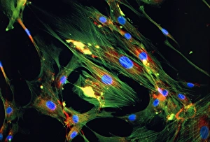 Immunofluorescent LM of skin fibroblast cells Immunofluorescent LM of skin fibroblast cells