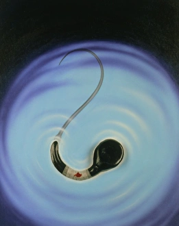 Infertility: Artwork of a sperm with bandage Infertility: Artwork of a sperm with bandage