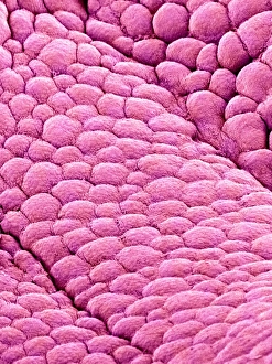 SEM Print of Uterus Internal Wall
