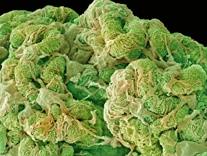 SEM Print of Kidney Glomerulus