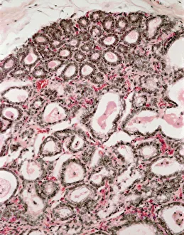 Lactating breast tissue, light micrograph Lactating breast tissue, light micrograph