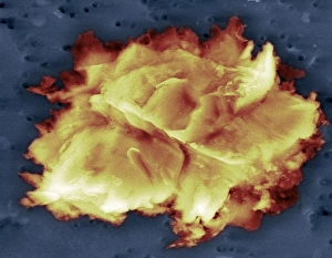 Lake Vostok micro-organism, SEM Lake Vostok micro-organism, SEM