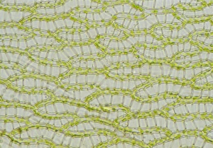 Sphagnum Moss Leaf Micrograph Print