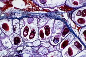 Light micrograph of beef tapeworm cysts in tongue Light micrograph of beef tapeworm cysts in tongue