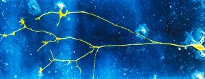 Human Nervous System Anatomy Prints: Light micrograph of a nerve cell