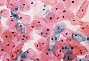 Prints of Light micrograph of normal cells in cervical smear Images Dated 2002 November: Light Micrograph Print of Normal Cervical Cells