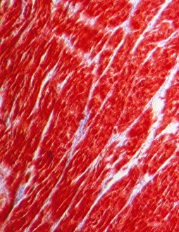Light micrograph of normal heart (cardiac) muscle Light micrograph of normal heart (cardiac) muscle