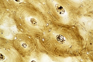 Light micrograph of normal human compact bone Light micrograph of normal human compact bone