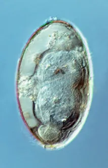 Liver fluke egg, macro photograph Liver fluke egg, macro photograph