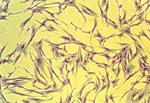 LM of aging genetically-engineered culture cells LM of aging genetically-engineered culture cells