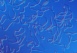 LM of Brugia malayi, worm causing human filariasis LM of Brugia malayi, worm causing human filariasis