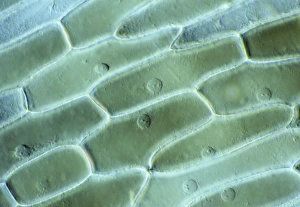 LM of cells in the epidermis of an onion LM of cells in the epidermis of an onion