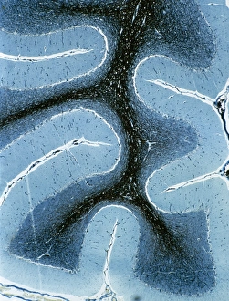 LM of cortex and medulla of the cerebellum LM of cortex and medulla of the cerebellum