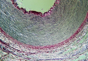 LM cross-section of a healthy human artery LM cross-section of a healthy human artery