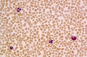 LM of a field of red and white blood cells LM of a field of red and white blood cells