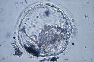 LM of human blastocyst, 4-5 days post-fertilisatn LM of human blastocyst, 4-5 days post-fertilisatn