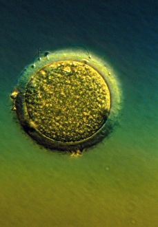 LM of human sperm fertilising an egg LM of human sperm fertilising an egg