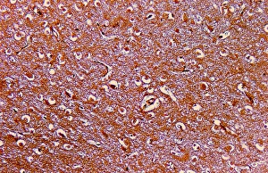 LM of nerve cells and fibres in brain tissue LM of nerve cells and fibres in brain tissue
