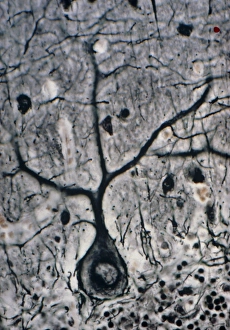 LM of a Purkinje cell in the cerebellum LM of a Purkinje cell in the cerebellum