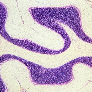 LM of section through cerebral cortex and medulla LM of section through cerebral cortex and medulla