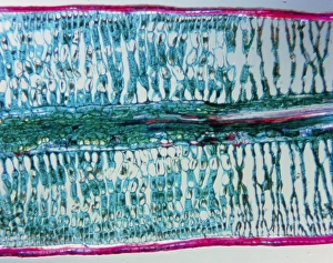 LM of a spruce leaf damaged by acid rain LM of a spruce leaf damaged by acid rain