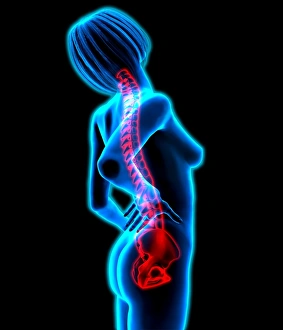 Lower Back Pain Print