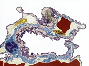 Prints of Lung tissue, coloured transmission electron micrograph (TEM). A single alveolus is at center. At top right is a pulmonary capillary containing a red blood cell (red) and a platelet (yellow) Images Dated 2008 May: TEM Print of Lung Tissue at x3500 Magnification