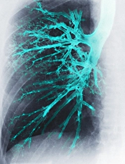 Respiratory System Diagram Prints: Lung, X-ray