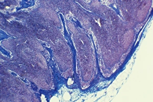 Immune System Cells Prints: Lymph node, light micrograph C015 / 6223