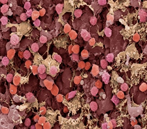 Lymph node, SEM Lymph node, SEM