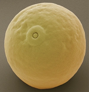 Coloured Scanning Electron Micrograph Prints: Maize pollen grain, SEM