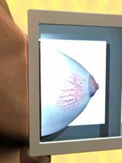 Medical Imaging Technology Prints: Mammogram, conceptual image