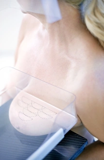 Mammography Print