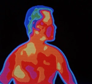Mans thermogram Mans thermogram