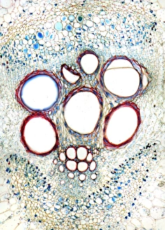 Marrow stem print, light micrograph