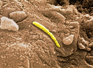 Martian microfossil, SEM Martian microfossil, SEM