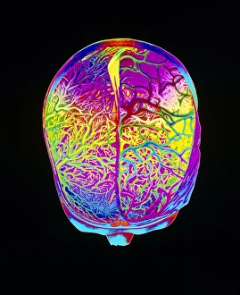 Mascagni artwork of human brain & blood vessels Mascagni artwork of human brain & blood vessels