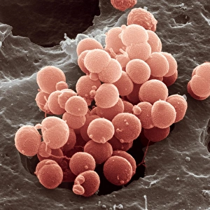 Antibiotic Treatment Options Prints: Meningitis bacteria, SEM