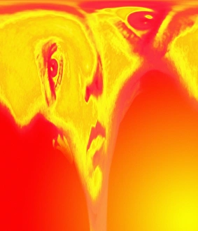 Images Dated 2nd June 2000: Mental disorder Print
