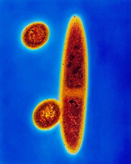 Methanospirillum hungatii bacteria Methanospirillum hungatii bacteria
