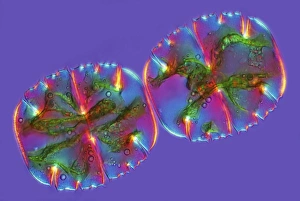 Polarised Light Microscopy Prints: Micrasterias desmids, light micrograph