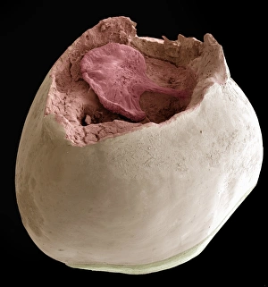 SEM Print of a Resorbed Milk Tooth Crown