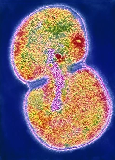 Moraxella catarrhalis bacterium dividing Moraxella catarrhalis bacterium dividing