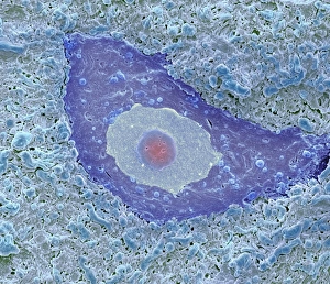 Nerve Cell Structure Prints: Motor neuron, SEM