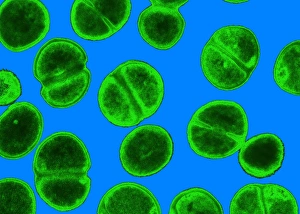 MRSA Bacteria Prints: MRSA bacteria